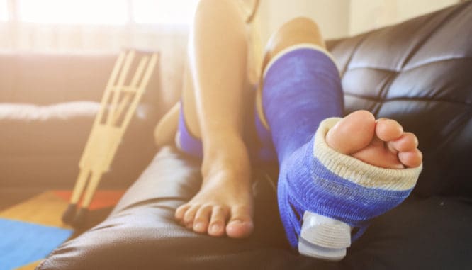 A broken leg in a blue plaster cast on a couch in soft focus; health care expenses are included in homeowner liability insurance